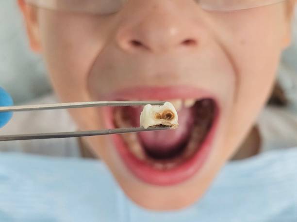 Best Emergency Dental Services for Seniors in Forest Oaks, NC